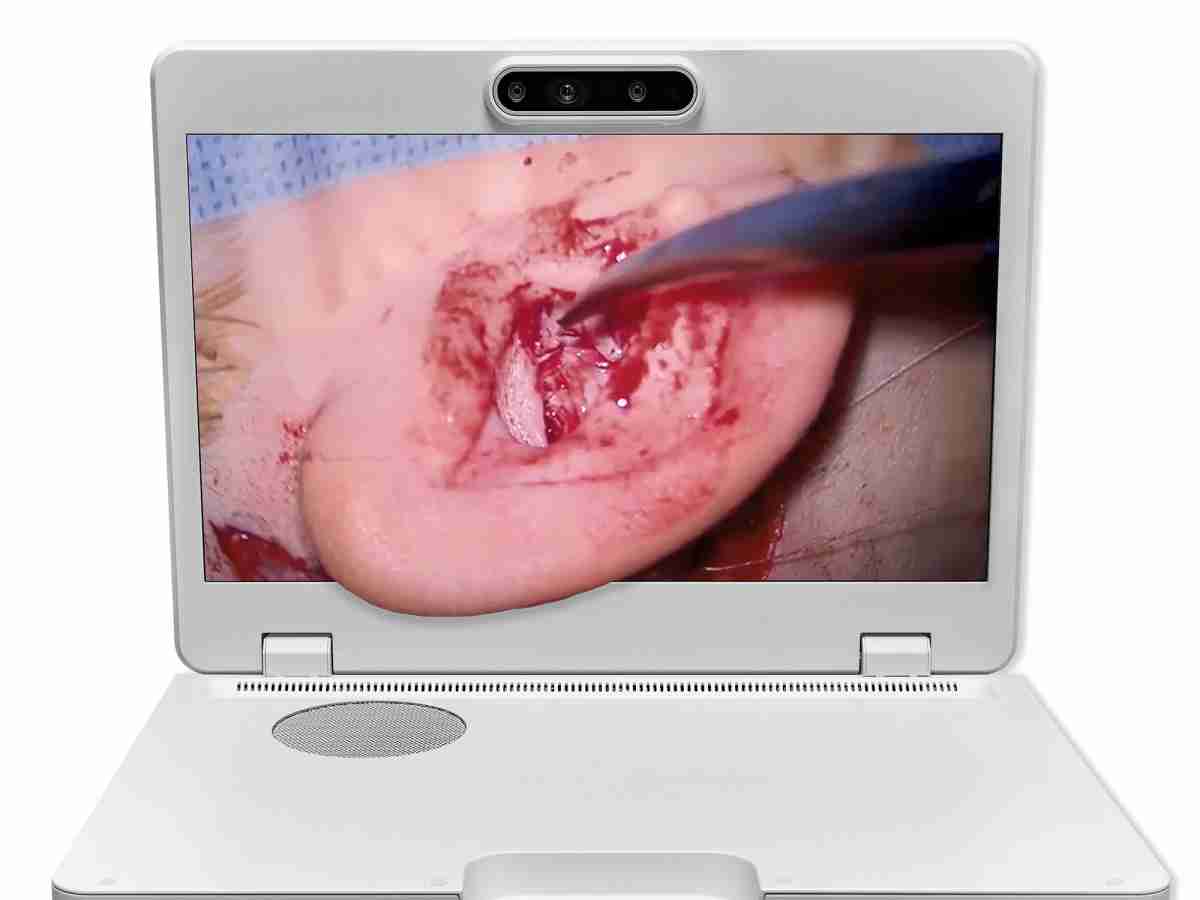 达擎之＂Heads-up 3D显微手术显示系统＂，，，，整合4K裸眼3D显示及眼球追踪系统，，，，具备快速追踪人眼移动位置功能，，，减轻医师长时间维持固定姿势的负担，，让医师能有更宽广清晰的3D立体视野及更舒适的姿势来执行手术。。。。